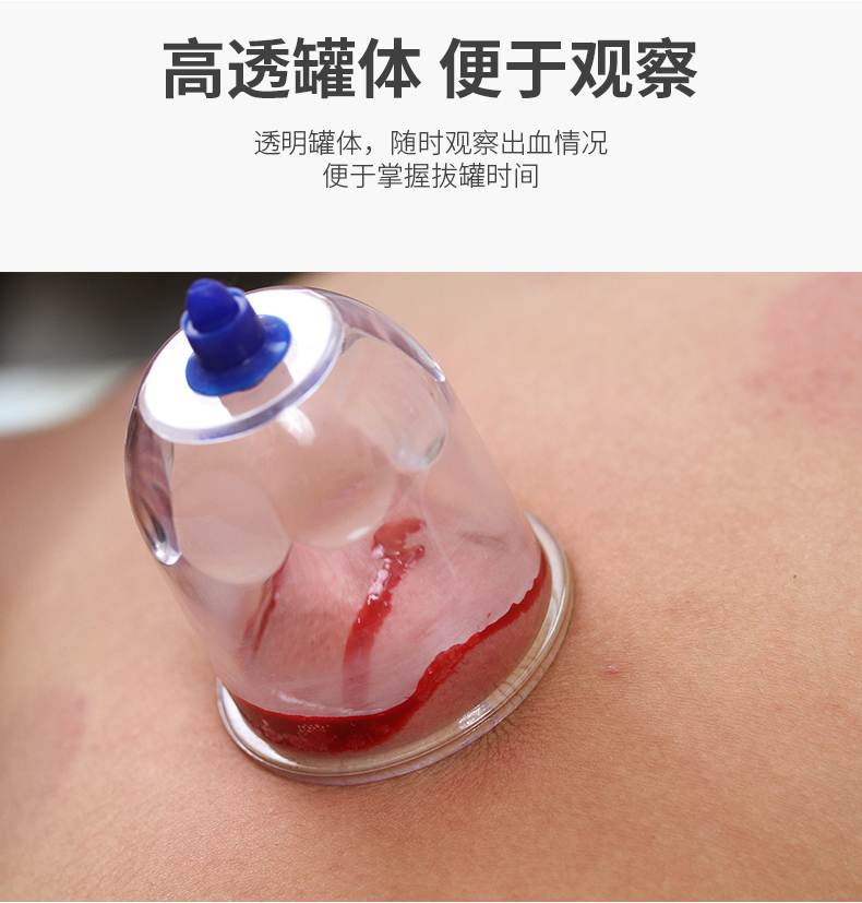 泻血刺络放血罐真空拔罐器家用抽气式气罐心天排淤拔血罐排瘀罐 蓝色