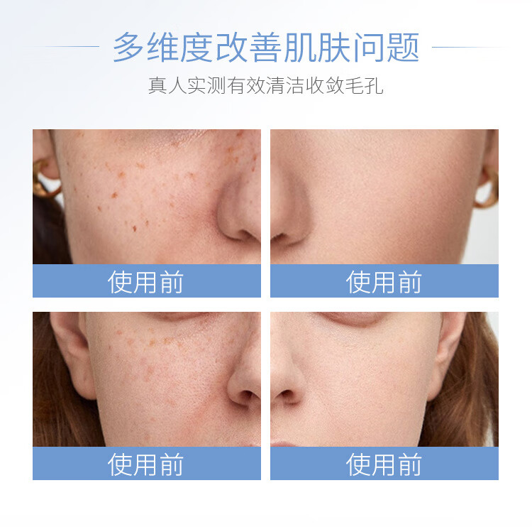 温博士【官方直售店】温博士维生素原B5面膜水杨酸清洁黑白头浩教授旗舰 1袋装升级款【浩教授B5面膜】300