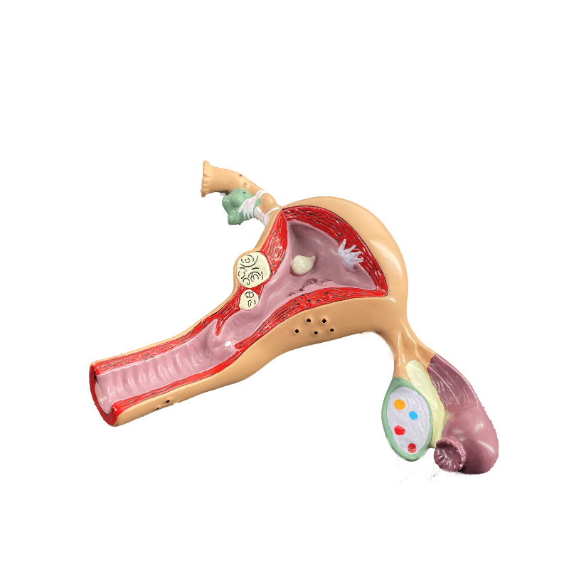 子宫附件模型图图片