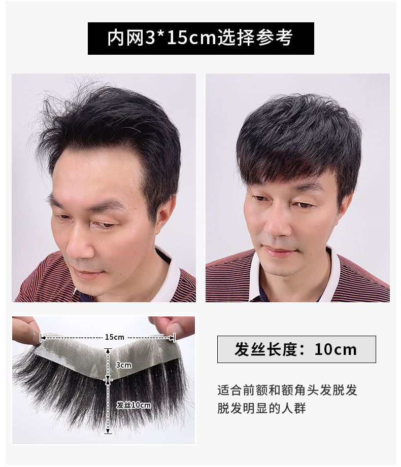 男士发际线假发贴前额补发片全真发秃顶补发逼真隐形无痕m型刘海2516