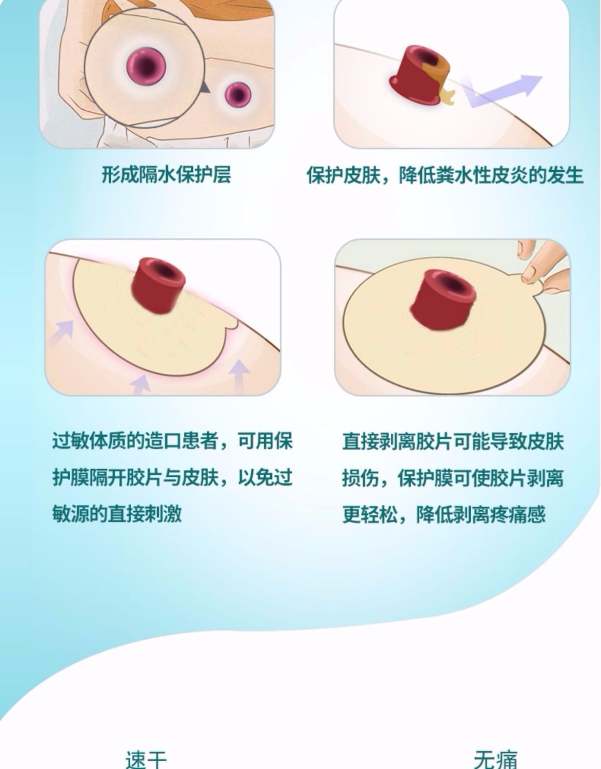 造口皮肤保护膜的用法图片