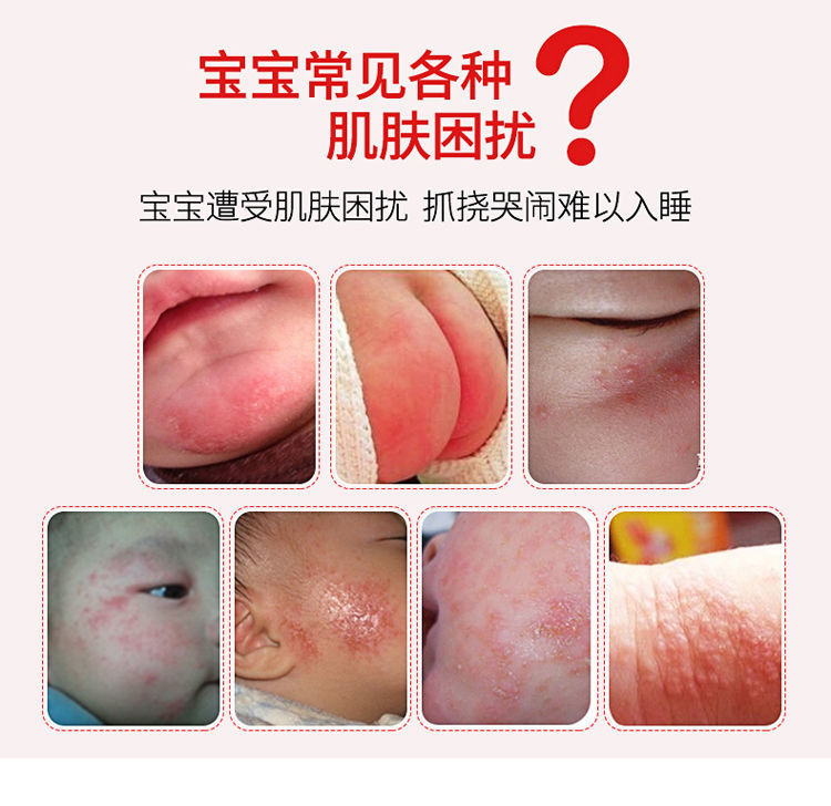 绿草元百卉膏百草宝宝婴幼儿百草膏皮肤止痒消毒堂婴儿湿痒红i疹儿童