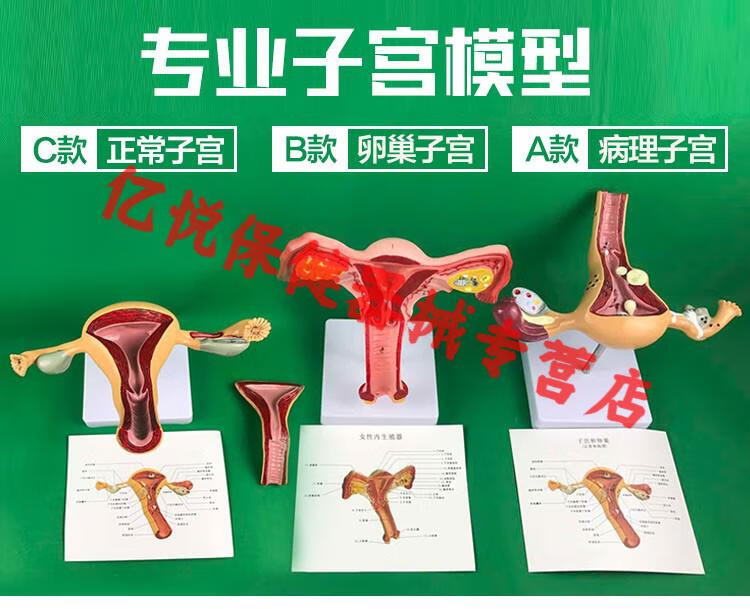 人體子宮模型教具模具卵巢解剖病理醫學女性仿真女性生殖模器a款病理