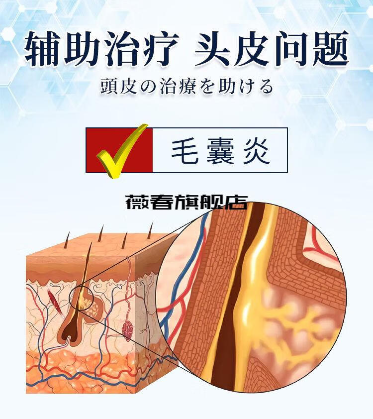 【官方旗舰】乐喜力丝头皮康液体敷料专攻头屑头痒 一盒装【图片 价格
