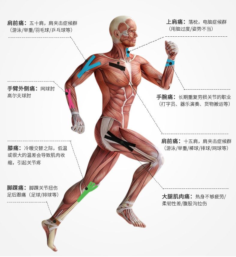 肌内效贴布胶布自粘绷带弹性运动绷带足球绷带肌肉贴肌贴胶带肤色25cm