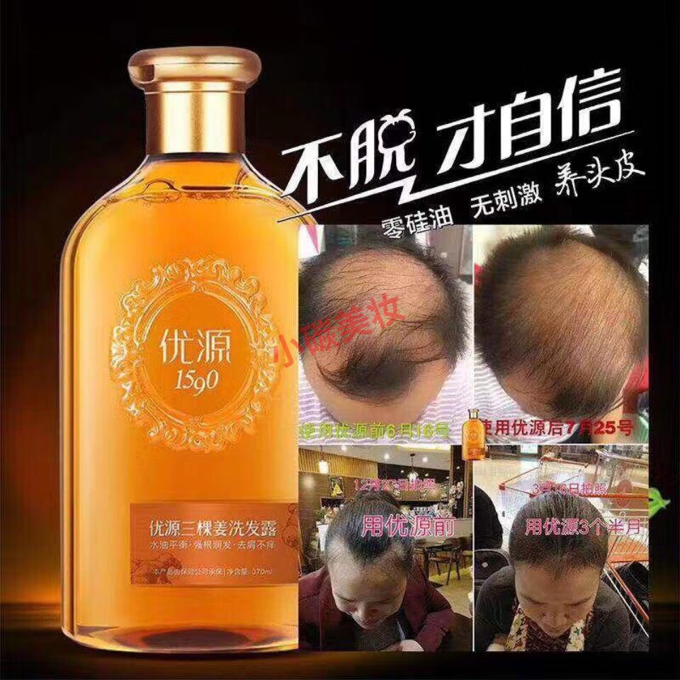优源洗发水一套三颗生姜无硅油掉断脱发洗发水 优源洗发水单品370ml