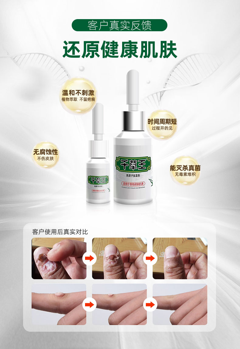 【官方旗舰】疣立净 【千草王】丝状i疣去除膏立净脖子上颈部扁平尤小