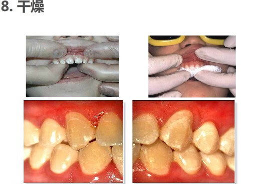 【官方旗舰】上海可配送 2022年新款 进口高·露洁多乐氟duraphat护齿
