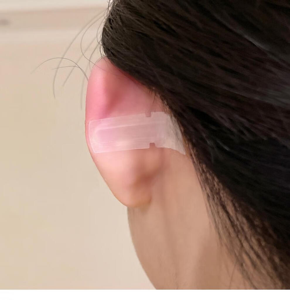 2022新款精灵耳贴神器贴面耳变招风耳立耳贴耳朵固定贴显脸小器撑耳朵