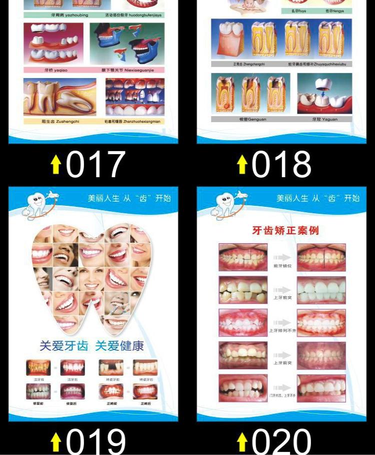 牙科诊所挂图烤瓷牙齿解剖图口腔知识海报贴纸宣传画kt板定制14二氧化