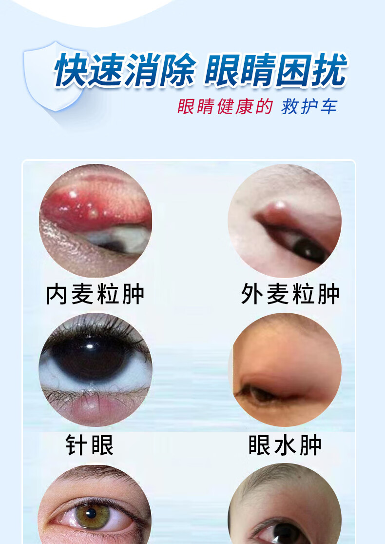 麦粒肿图片大全图片