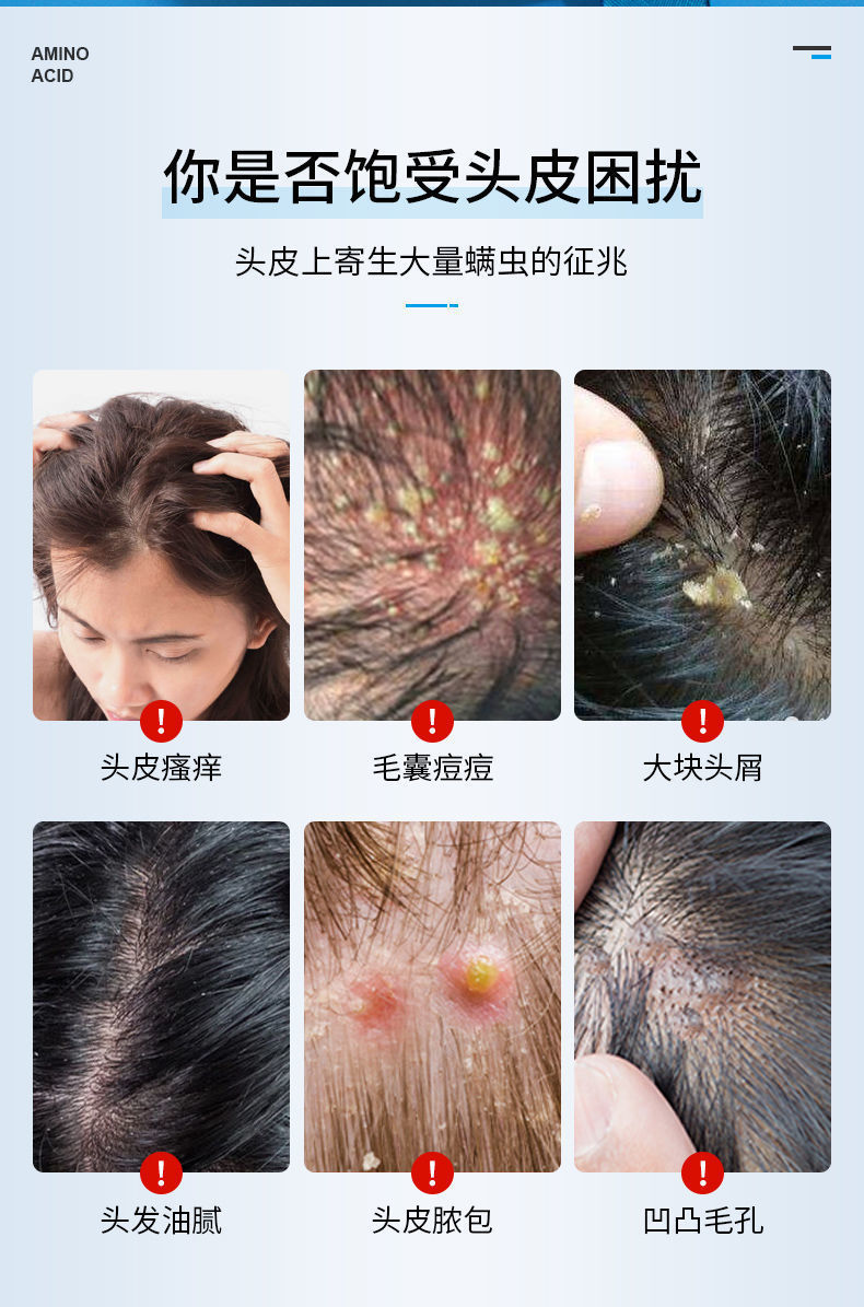 南京同仁堂治毛囊焱炎洗发水去屑脓包头除螨虫疙瘩止痒露洗发露一瓶