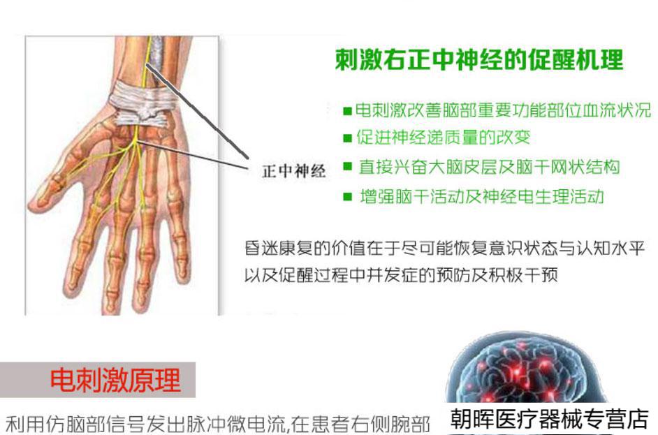 植物人昏迷催意识 右正中神经刺激促醒仪 颅脑损伤电刺激唤醒 配仪器