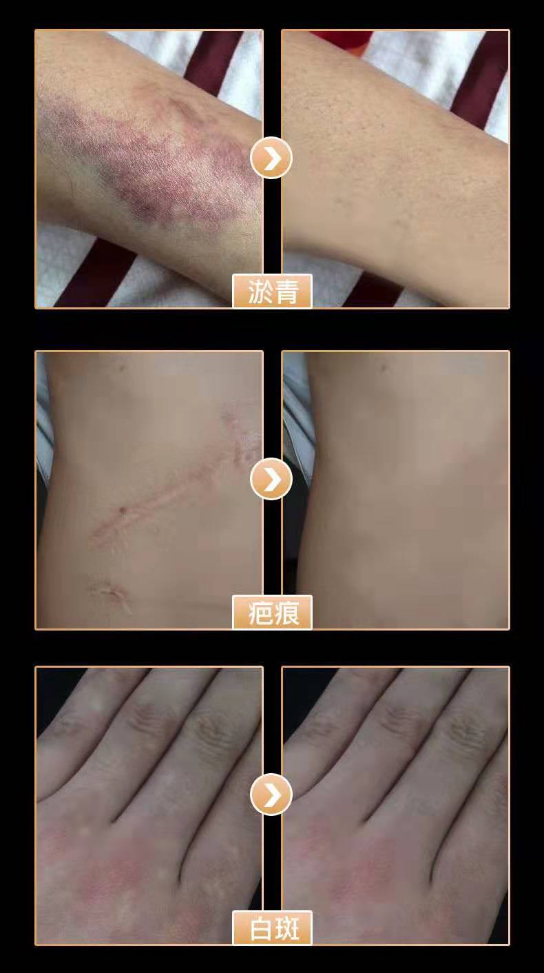 纹身遮瑕膏遮盖纹身胎记疤痕假皮肤隐形贴胶带强力遮挡覆水 10克双色