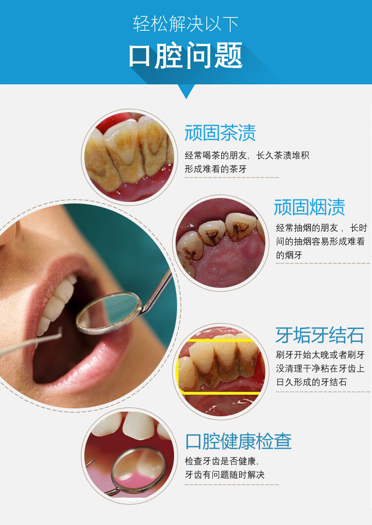 牙结石去除器洗牙牙石清除牙垢牙医口腔工具家用剔牙牙齿清洁神器 304