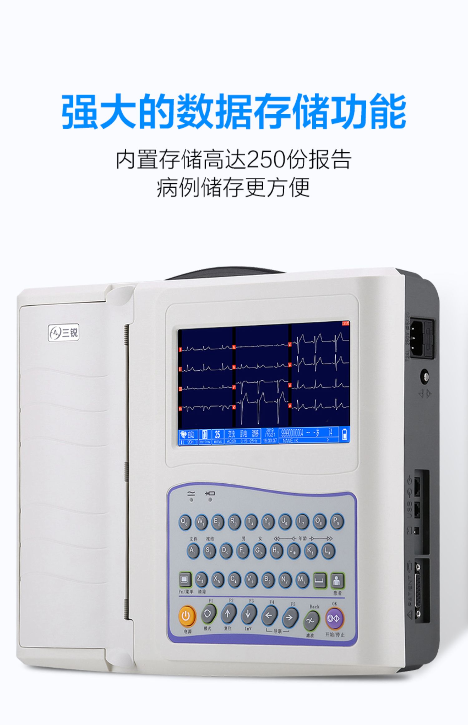 正常心电图机参数图片