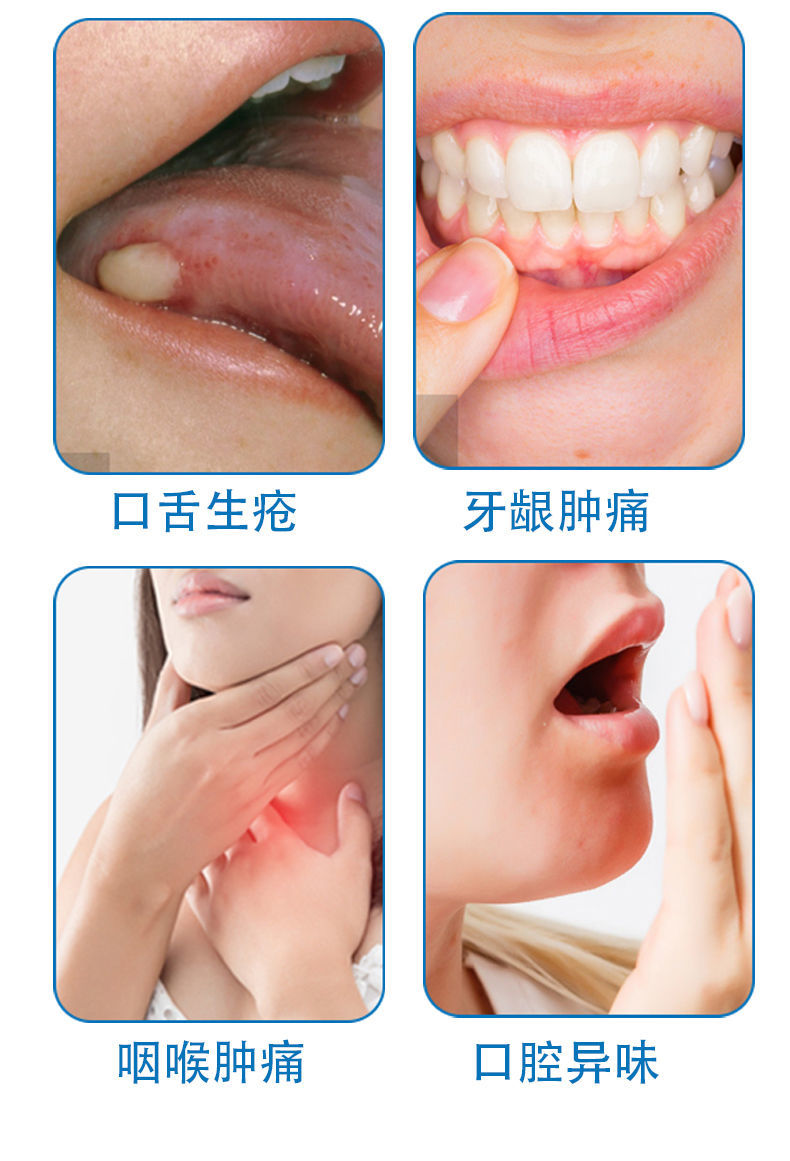 盛世三诚牙康宁口腔溃疡喷剂灵液烂嘴巴上火起泡止x痛口舌头生疮溃疡