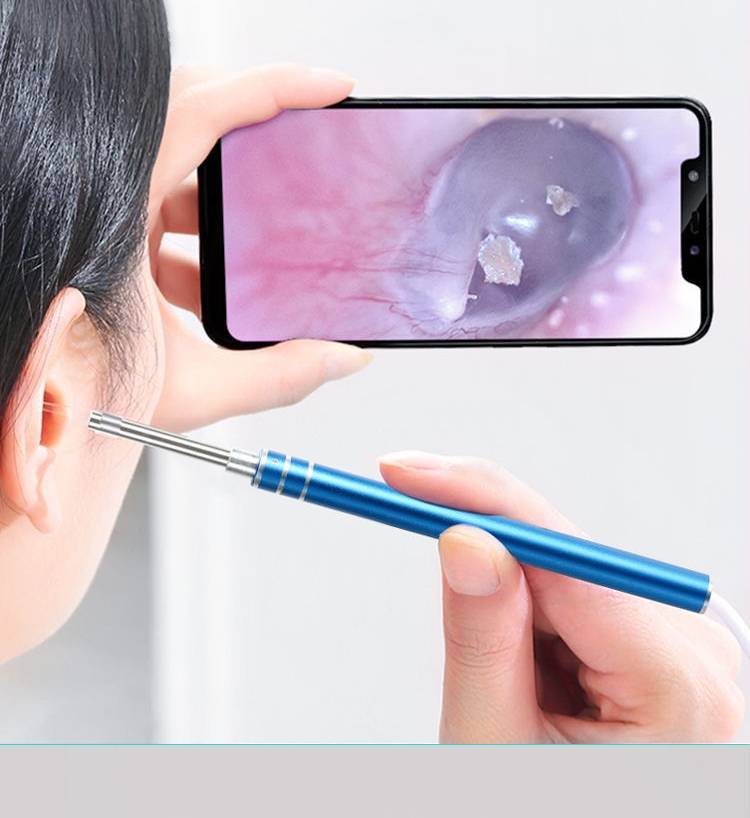 可视掏耳勺高清 可视采耳仪器高清掏耳勺内窥镜耳内镜高清挖耳勺智能