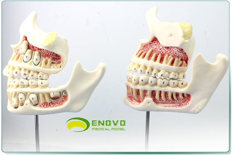 enovo颐诺儿童牙列与颌骨发育模型 乳牙恒牙幼儿口腔牙齿发育牙列保健
