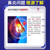 Rhinitis root medicine to treat allergic rhinitis, sinusitis, itchy and runny nose, sneezing, ear, nose and throat medication, ketotifen fumarate tablets for adults (visual effects), 2 bottles, nasal congestion, itchy and runny nose