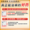 Xiangyu Lekang Ketotifen Fumarate Tablets, special medicine for rhinitis, rhinitis medicine to treat allergic rhinitis, sinusitis, itchy nose, runny nose and sneezing, visual effects, 1mg*60 tablets, 1 bottle, authentic Chinese medicine, specially designed to treat old rhinitis