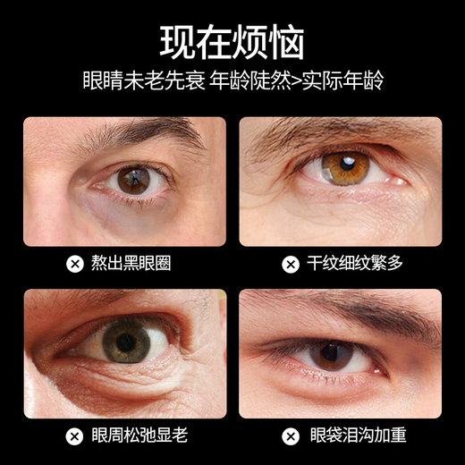 sakose Vaseline Retinol Firming Anti-Wrinkle Men's Eye Cream 30g Lightening Fine Lines Eye Bags Dark Circles Eye Skin Care Products

