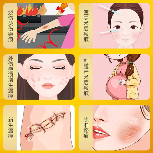 【原研进口】康瑞保 复方肝素钠尿囊素凝胶 10g/盒