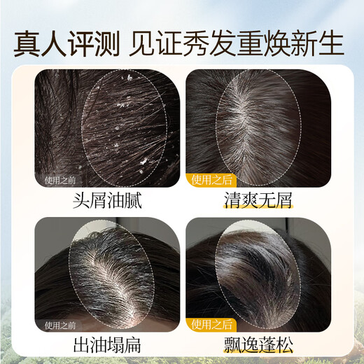 Bawang Ginger Shampoo Ginger Juice Shouwu Anti-Dandruff Anti-itch Shampoo Shampoo Fresh and Refreshing 1L