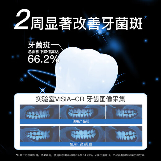 Bayer G1s flagship electric toothbrush adult charging smart sonic soft bristle cleaning gum protection couple set automatic men and women gift to friends and students gift box