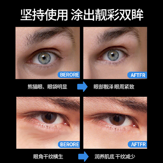 sakose Vaseline Retinol Firming Anti-Wrinkle Men's Eye Cream 30g Lightening Fine Lines Eye Bags Dark Circles Eye Skin Care Products
