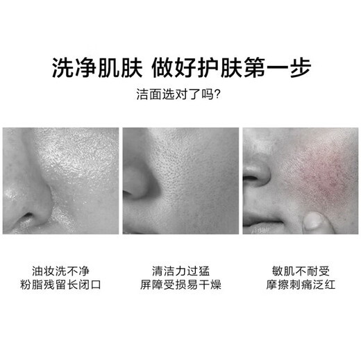 一叶子（one leaf）洗面奶男女补水保湿控油深透清洁青少年学生套装洁面乳护肤品正品 【买1送1】温和净澈洁面到手160g