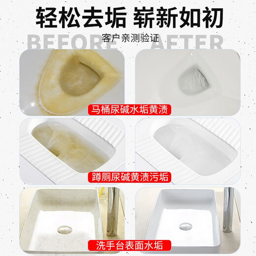 千居惠尿碱溶解剂强力融通尿垢除垢去污去黄除臭尿检洗厕所马桶清洁去味 尿碱溶解剂 1050g 3瓶