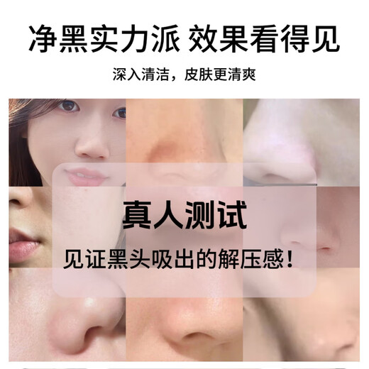 M arlincare blackhead suction instrument, blackhead suction instrument, blackhead cleaning artifact, clean pores and remove blackhead artifact, electric home cold compress red light blackhead suction instrument, gift for personal use, basic model, Yunqinglan, vacuum negative suction