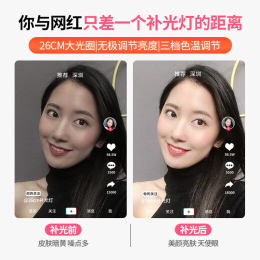 Yangfeisi YS1 mobile live broadcast bracket, fill light, anchor beauty lamp, floor-standing tripod, postgraduate entrance examination re-examination bracket, Douyin Kuaishou Internet celebrity online class shooting short video equipment selfie stick artifact