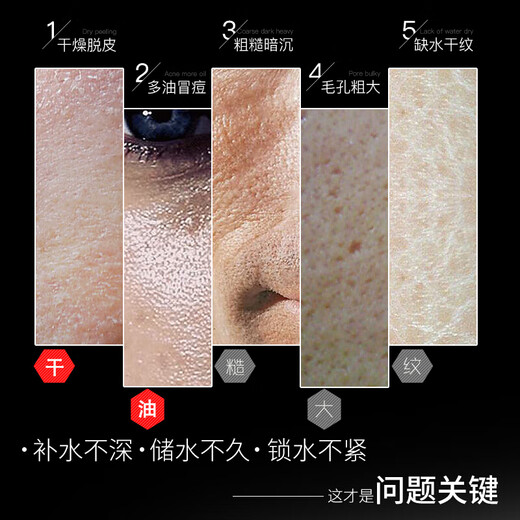 Hefengyu men's skin care set (facial cleanser + toner + lotion) hydrating, moisturizing, oil-controlling lotion gift box, balancing set + body wash + body lotion