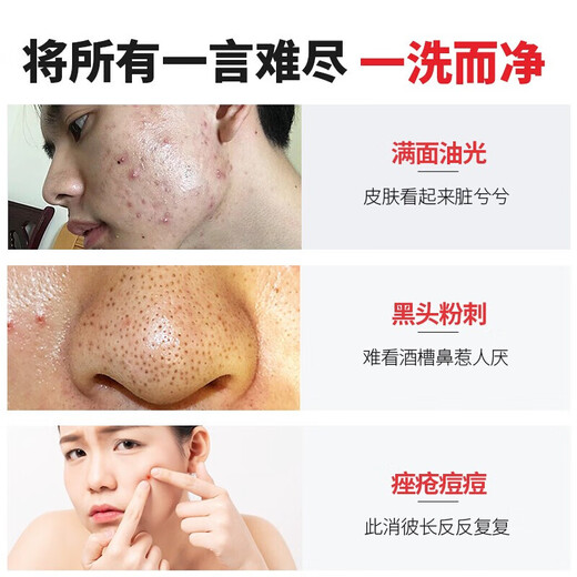 Nanjing Tong Ren Tang Acne Cleansing Milk Men and Women Youth Exfoliating Oil Control Blackhead Pore Shrinking Cleansing Milk 200g Chinese Valentine's Day