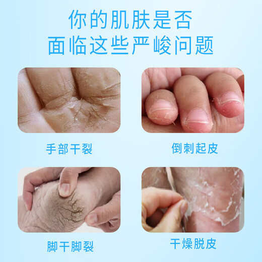 Sakose Vaseline moisturizing and repairing foot mask 3 pairs + hand mask 3 pairs 40g/pair hand cream to remove dead skin and whiten feet