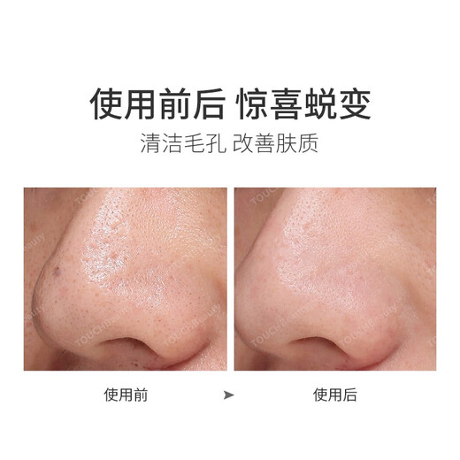 TOUCHBeauty Blackhead Instrument Ultrasonic Blackhead Peeling Machine Cleansing Pore Cleaner Electric Acne Remover Facial Massage Beauty Instrument Birthday Gift for Men and Women Ultrasonic Blackhead Instrument