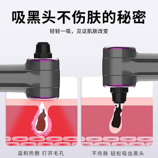VLVEE blackhead suction instrument, cleaning artifact, blackhead extractor, facial hot compress introduction instrument, pore cleaning instrument, beauty instrument, starry sky gray, hot compress introduction + 3-level adjustment