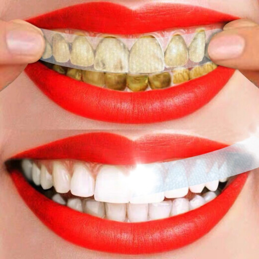 Beautiful Eyes, Hopeful Teeth Patch, Beautiful White Teeth, Remove Yellow Teeth, White Teeth Whitening Patch, Fresh Breath 14 Pieces/Box of Six Boxes of Teeth Patch (Severe Yellow Teeth) [84 Pieces]