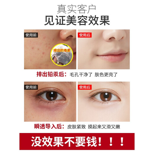 VLVEE Ultrasonic Beauty Instrument Export and Import Instrument Beauty Salon Special Instrument Facial Lifting Firming Facial Massage Oxygen Injection Hydration Instrument Pore Cleaning Home Ultrasonic Basic Model Single Probe