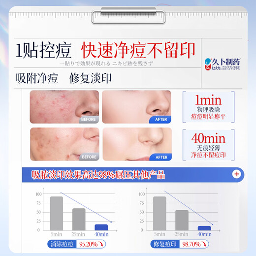 Jiubu Pharmaceutical Medical Acne Patch eliminates pus inflammation, invisible, thin, acne-removing artificial skin, repairs and fades concealer patch 108 patches/box