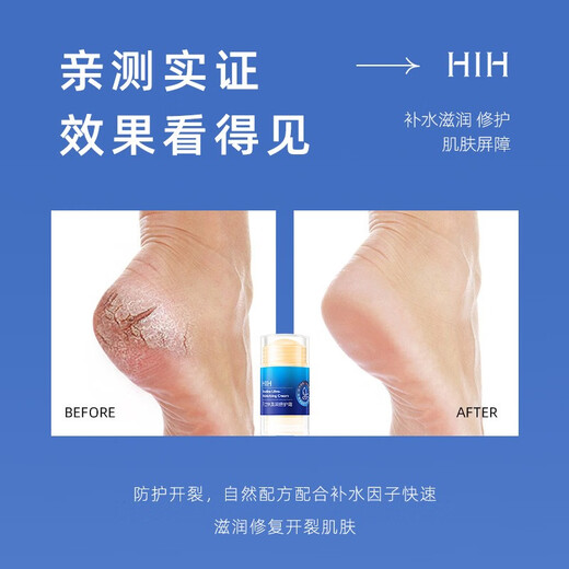 HIH 2-pack Vaseline Hand and Foot Anti-Crack Cream, Hand, Foot and Heel Cream to Remove Peeling and Cracked Cream 35g Vaseline Hand and Foot Anti-Crack Cream