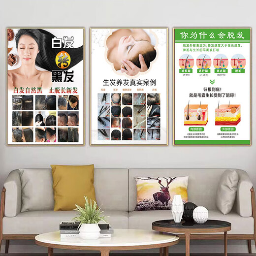 Chengliu Kopfhaut Haarfollikel Erkennung Bilder Haarwachstumsposter Haarstruktur Bild Werbung Haarausfall Grade Hängende Gemälde Kopfhaut FAQ 16852 PS Fotorahmen Malmalerei (Dicke 25 mm) 24 Zoll (40-60 cm)