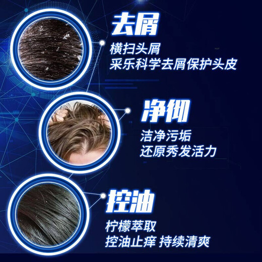 采乐酮康去屑洗发水止痒控油柔顺洗发露去头皮清洁洗头清爽去头屑男女 【去屑止痒】750ml+80ml