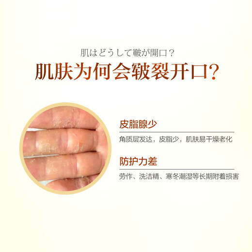 Wei Xiang'er Japanese horse oil hand and foot anti-crack cream 50g, autumn and winter removal of cracked feet, cracked hands, cracked heels, cracked cracks, moisturizing hand cream, universal for men and women