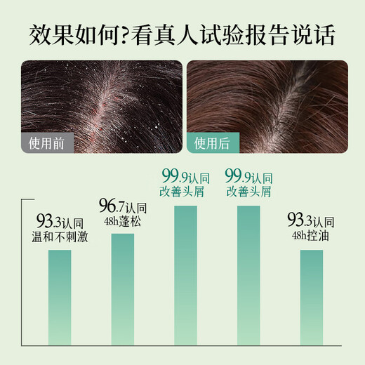 Ruyi (Ruyi) Salicylsäure-Shampoo für Männer und Frauen, um Schuppen und Juckreiz zu entfernen und Öl lang anhaltende, flauschige, silikonfreie Öl Shampoo-Goldliste Nr. 1 zu kontrollieren