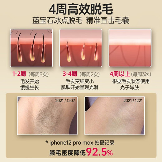 KONKA Hair Removal Device Freezing Point Laser Hair Removal Device Medical Painless Hair Removal Device Home Shaver Full Body Armpit Hair Removal as a Birthday Gift for Boyfriend and Girlfriend 1.65 million units sold Accelerate light output + Stubborn thickening of hard hair without leaving black spots