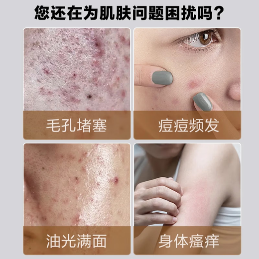 JD Logistics Sulfur Soap, Mite Removing Absolute Oil, Toning Back Bath Soap, 70g 3 Pieces