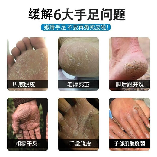 Longliqi snake oil hand cream hand mask hydrating, moisturizing, anti-drying, rejuvenating, non-greasy, refreshing for men and women 70g hand cream 70g*10 pieces